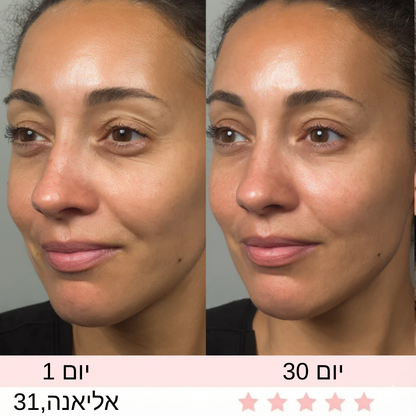 מכשיר חידוש   העיניים של Aluréa