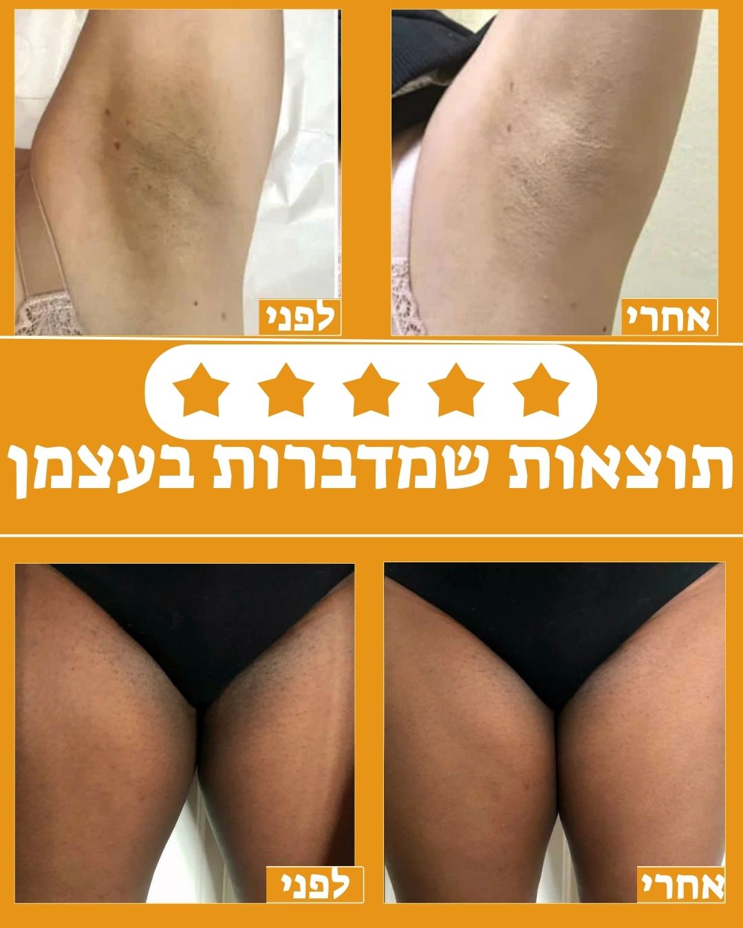 ספריי ההבהרה של Aluréa