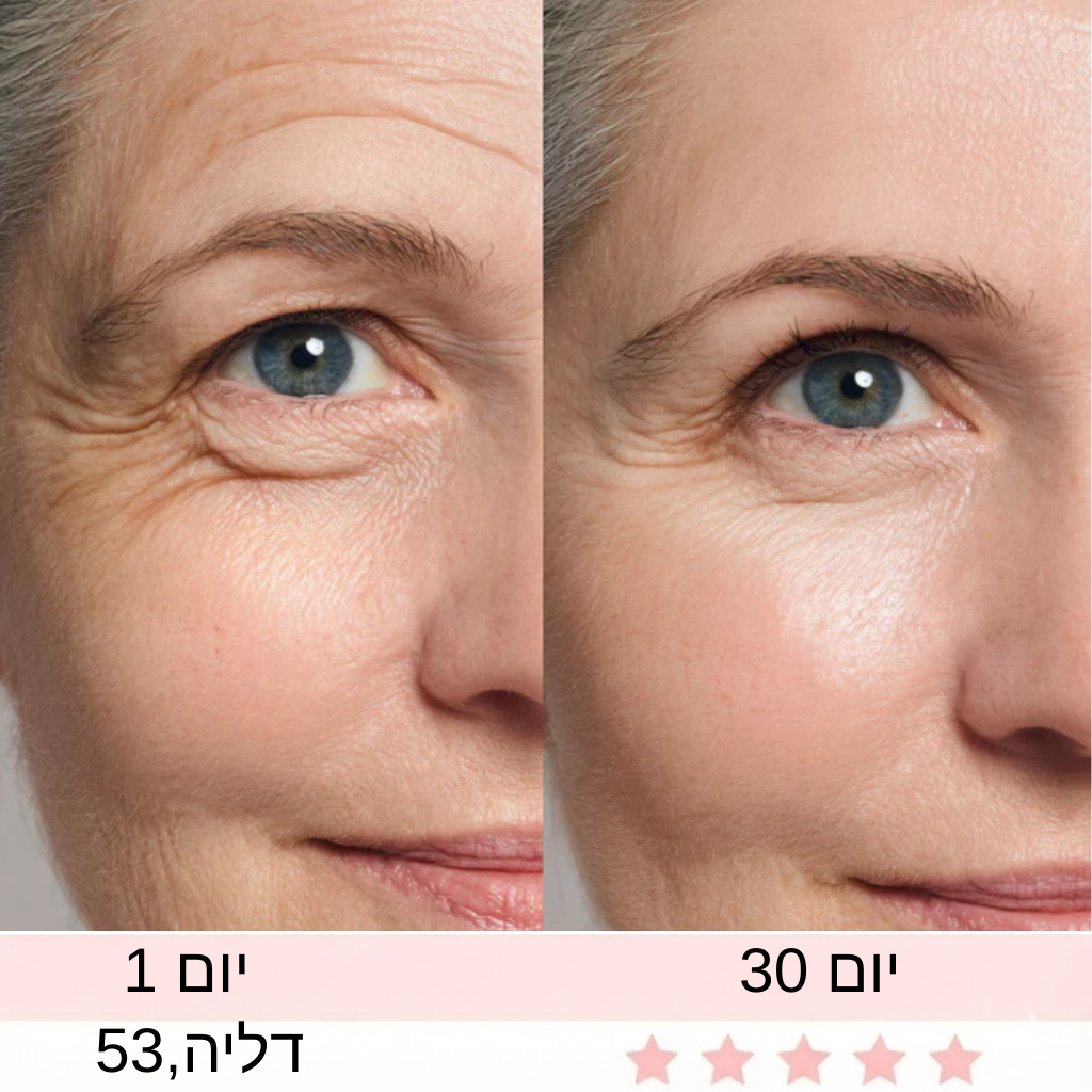 מכשיר חידוש   העיניים של Aluréa