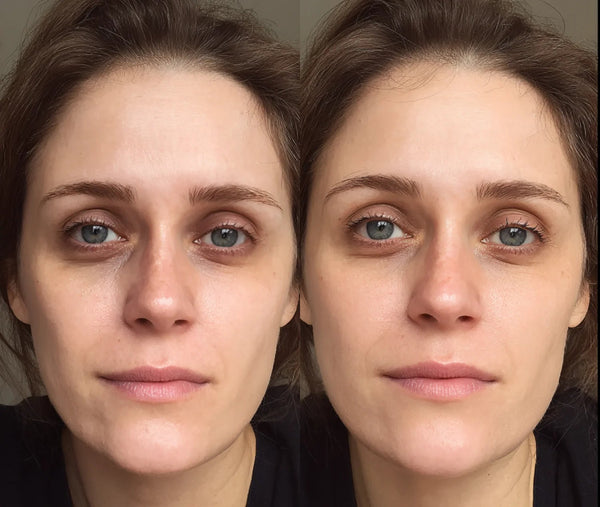 אליסון רוזן